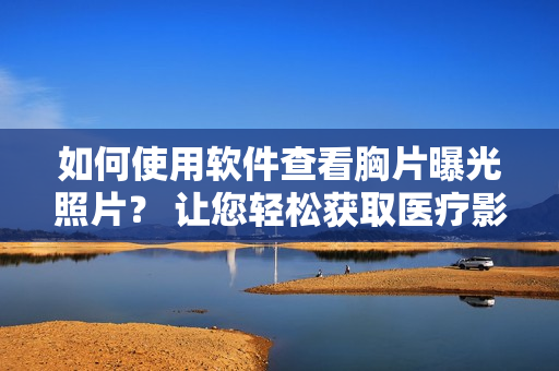 如何使用軟件查看胸片曝光照片？ 讓您輕松獲取醫(yī)療影像結果